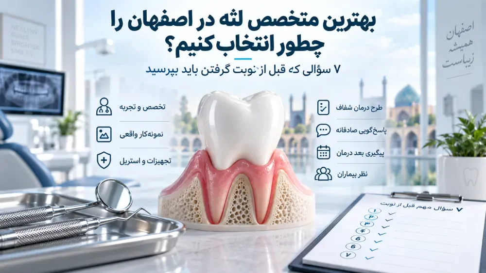 بهترین متخصص لثه در اصفهان را چطور انتخاب کنیم؟ ۷ سؤالی که قبل از نوبت گرفتن باید بپرسید